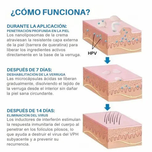 Crema para el alivio de las verrugas genitales 3 en 1 Luminiix® Tienda Colombia