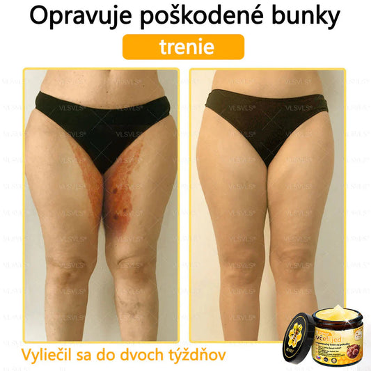Compra 1 Lleva 3 + 5 Obsequios - Crema renovadora de piel con veneno de abeja VLSVLS™ Tienda Colombia