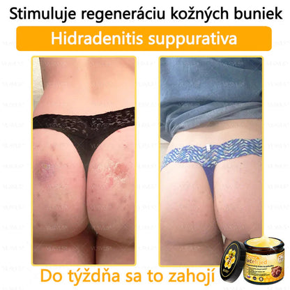 Compra 1 Lleva 3 + 5 Obsequios - Crema renovadora de piel con veneno de abeja VLSVLS™ Tienda Colombia