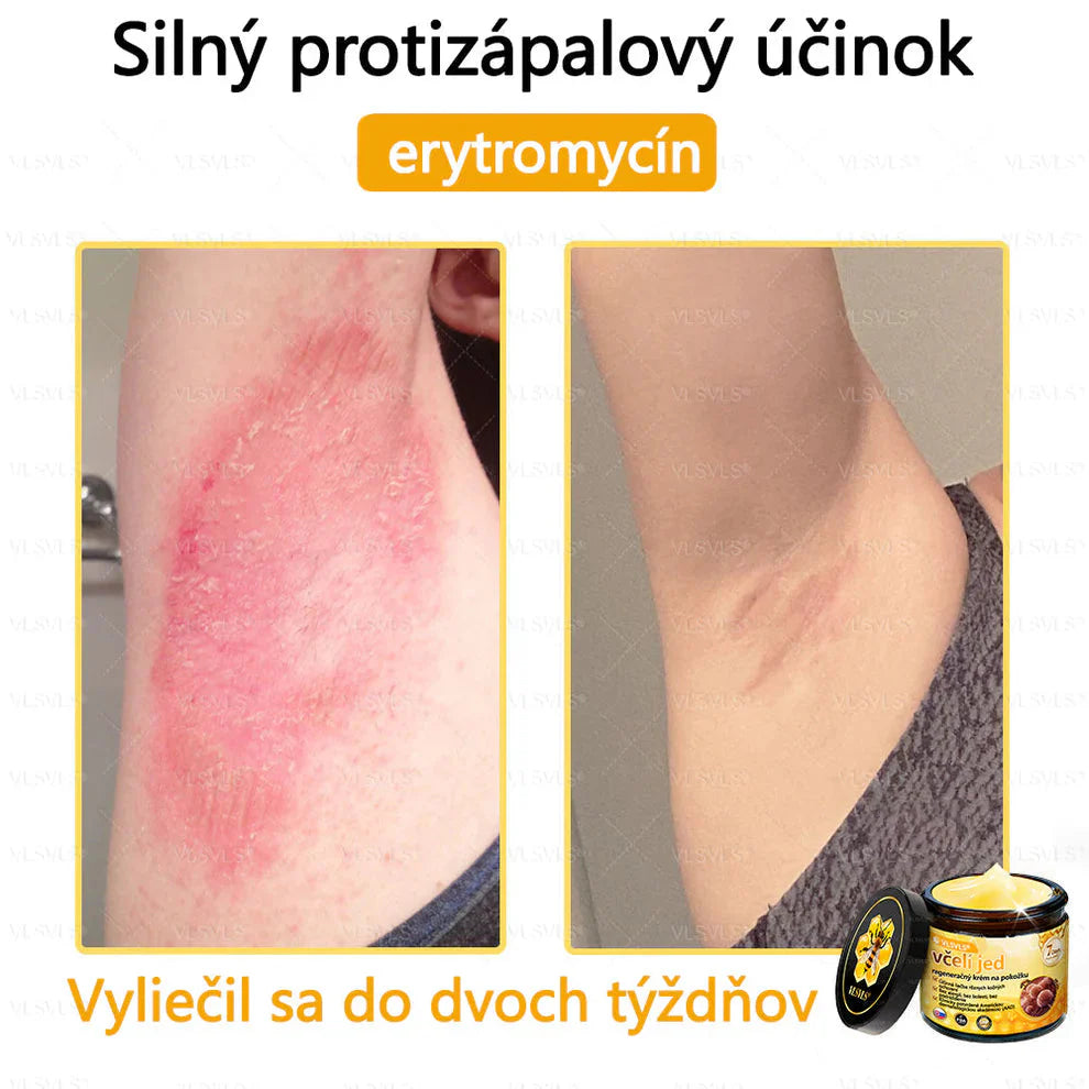 Compra 1 Lleva 3 + 5 Obsequios - Crema renovadora de piel con veneno de abeja VLSVLS™ Tienda Colombia