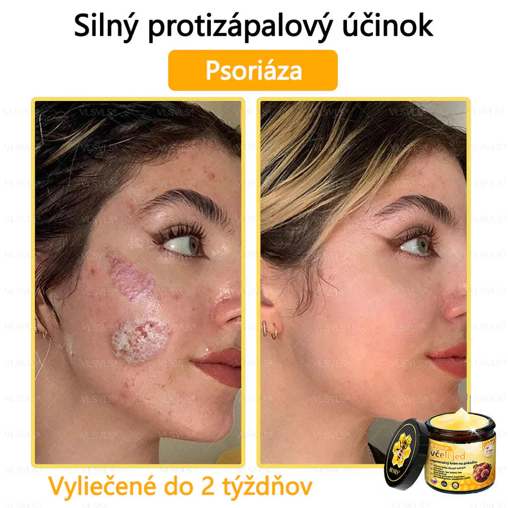Compra 1 Lleva 3 + 5 Obsequios - Crema renovadora de piel con veneno de abeja VLSVLS™ Tienda Colombia