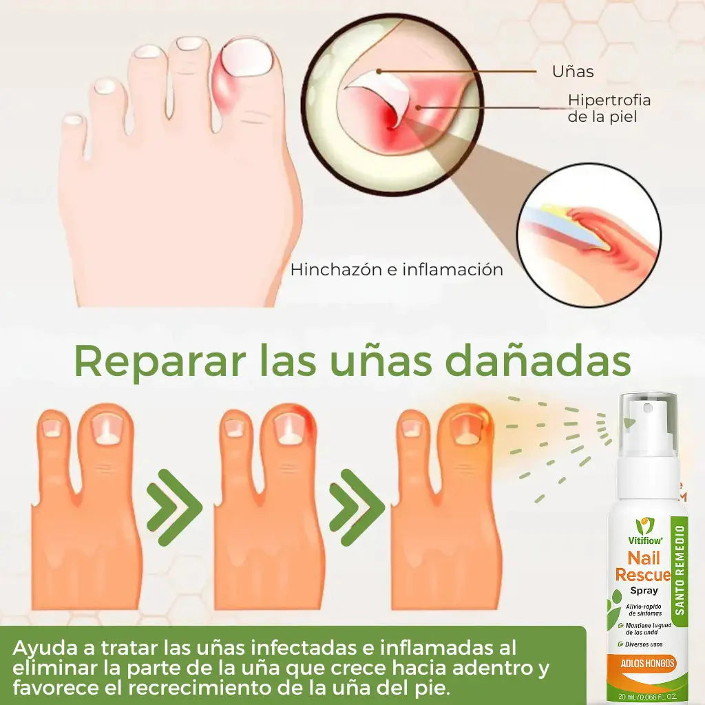 COMPRE 1 LLEVE 2 - NailRescue Spray de veneno de abeja Tienda Colombia