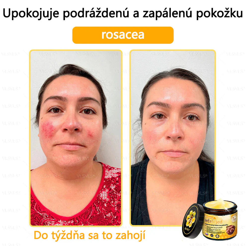 Compra 1 Lleva 3 + 5 Obsequios - Crema renovadora de piel con veneno de abeja VLSVLS™ Tienda Colombia