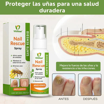 COMPRE 1 LLEVE 2 - NailRescue Spray de veneno de abeja Tienda Colombia
