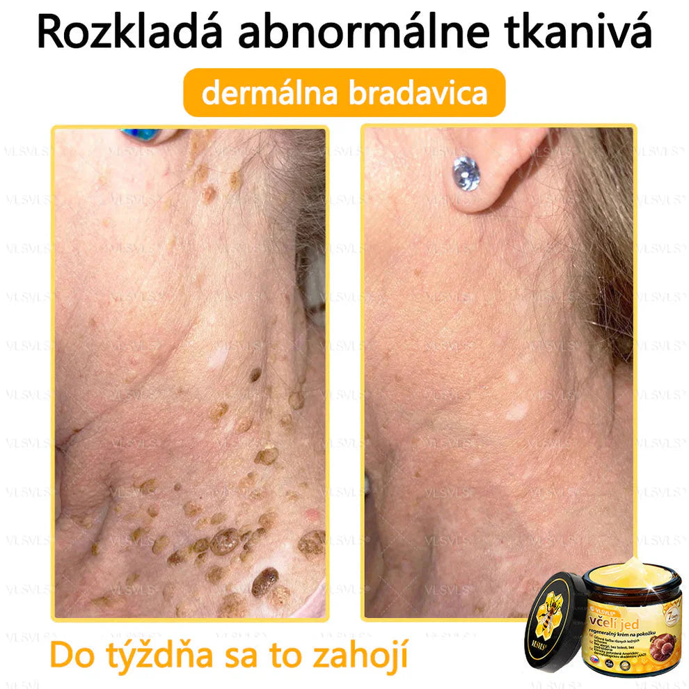 Compra 1 Lleva 3 + 5 Obsequios - Crema renovadora de piel con veneno de abeja VLSVLS™ Tienda Colombia