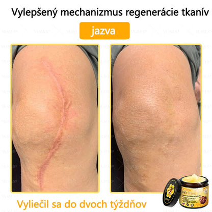 Compra 1 Lleva 3 + 5 Obsequios - Crema renovadora de piel con veneno de abeja VLSVLS™ Tienda Colombia