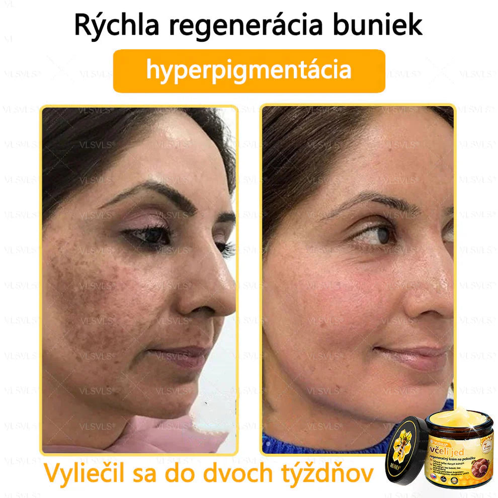 Compra 1 Lleva 3 + 5 Obsequios - Crema renovadora de piel con veneno de abeja VLSVLS™ Tienda Colombia