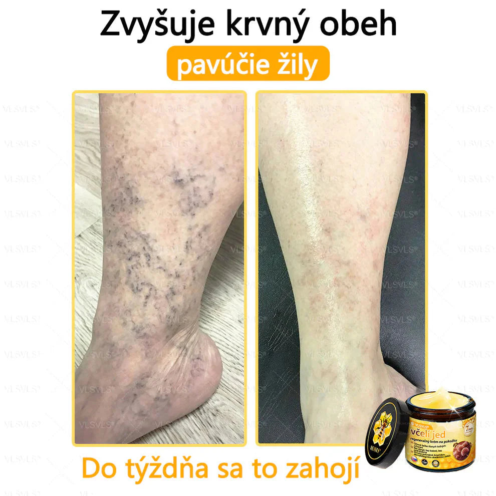 Compra 1 Lleva 3 + 5 Obsequios - Crema renovadora de piel con veneno de abeja VLSVLS™ Tienda Colombia